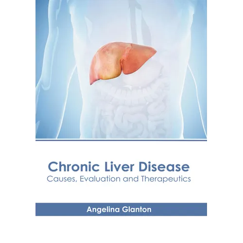 Chronic Liver Disease: Causes, Evaluation and Therapeutics