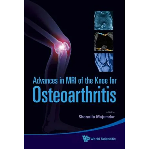 Adv in MRI of the Knee for Osteoarthriti