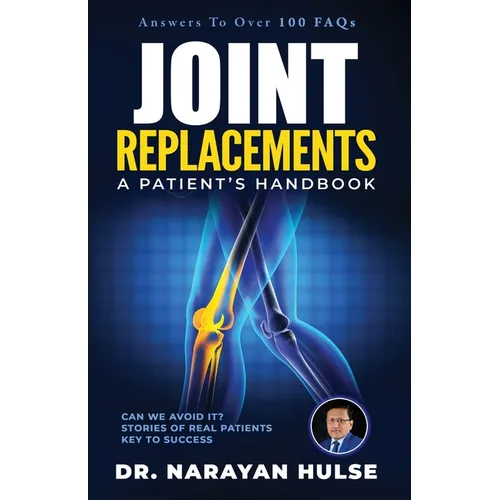 Joint Replacements: A Patient's Handbook