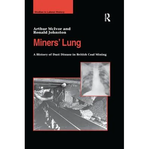 Miners' Lung: A History of Dust Disease in British Coal Mining