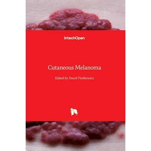 Cutaneous Melanoma