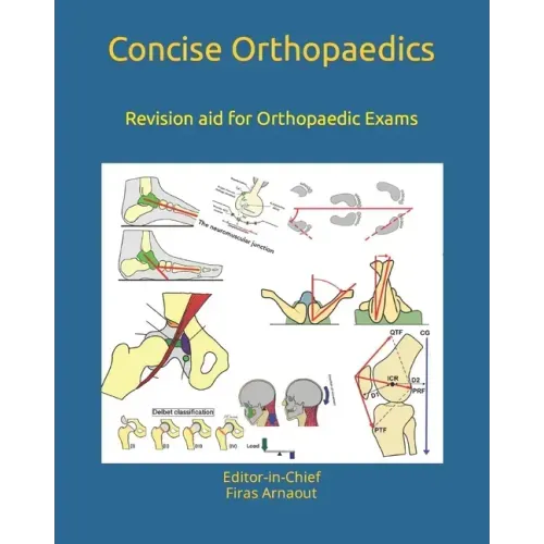 Concise Orthopaedic Notes: Revision aid for FRCS, EBOT , SICOT and Board Examinations