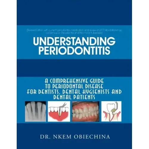 Understanding Periodontitis: A Comprehensive Guide to Periodontal Disease for Dentists, Dental Hygienists and Dental Patients