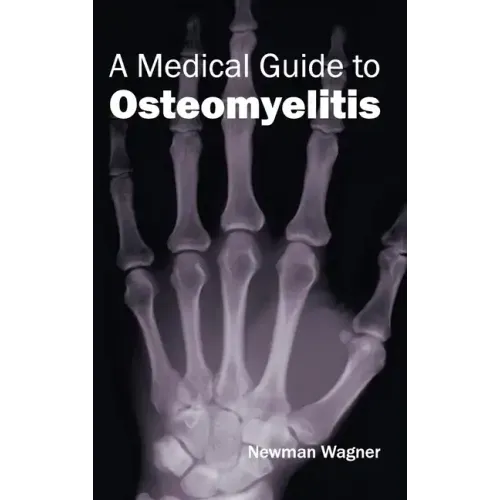 Medical Guide to Osteomyelitis