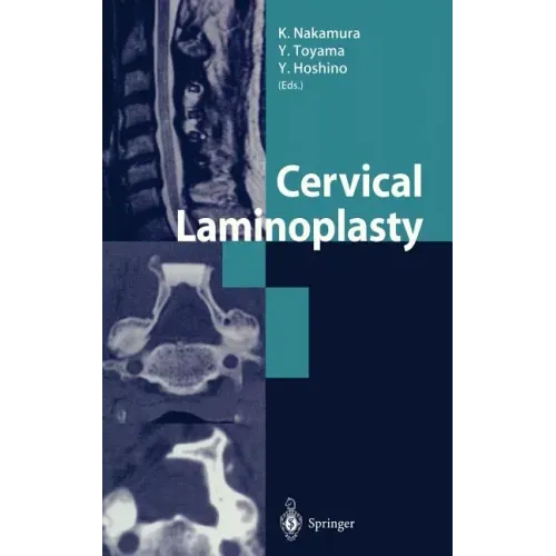 Cervical Laminoplasty