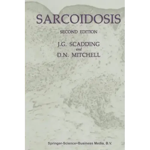 Sarcoidosis