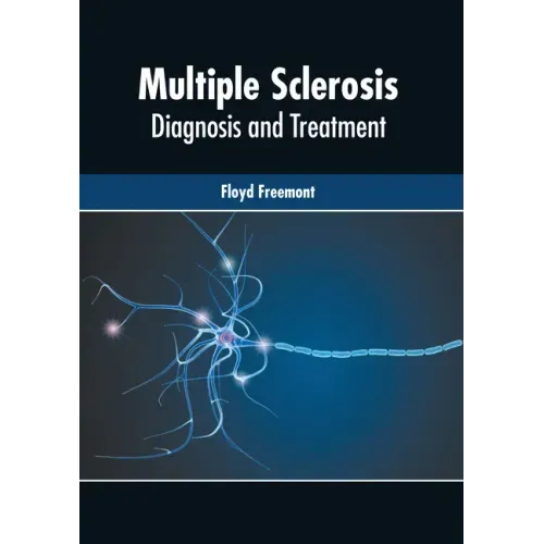 Multiple Sclerosis: Diagnosis and Treatment
