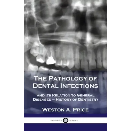 Pathology of Dental Infections: and Its Relation to General Diseases - History of Dentistry