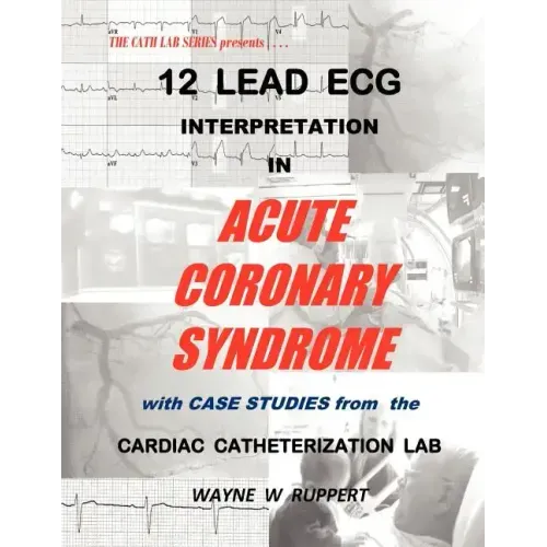 12 Lead ECG Interpretation in Acute Coronary Syndrome with Case Studies from the Cardiac Catheterization Lab