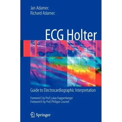 ECG Holter: Guide to Electrocardiographic Interpretation