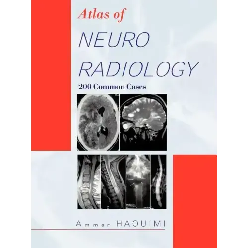 Atlas of Neuroradiology: 200 Common Cases