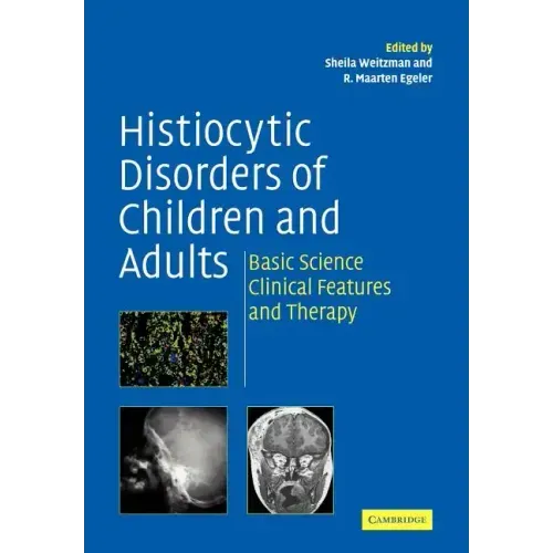 Histiocytic Disorders of Children and Adults: Basic Science, Clinical Features and Therapy
