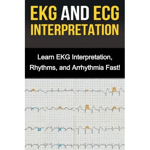 EKG and ECG Interpretation: Learn EKG Interpretation, Rhythms, and Arrhythmia Fast!