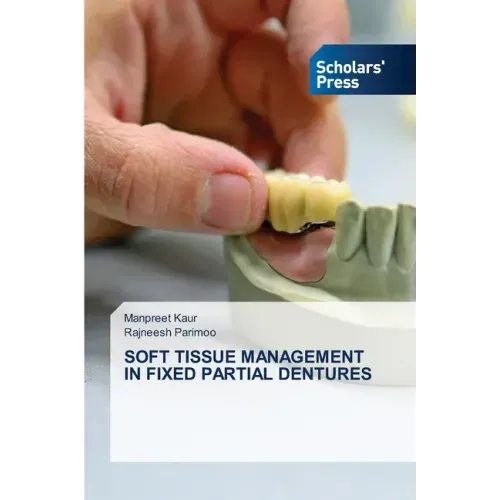 Soft Tissue Management in Fixed Partial Dentures