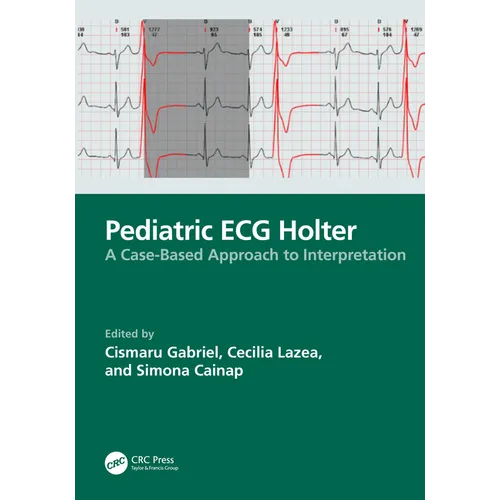 Pediatric ECG Holter: A Case-Based Approach to Interpretation