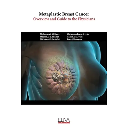 Metaplastic Breast Cancer: Overview and guide to the physicians