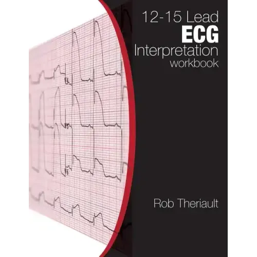 12-15 Lead ECG Interpretation: Workbook