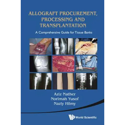 Allograft Procurement, Processing and ..