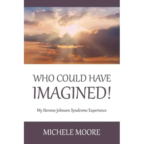 Who Could Have Imagined!: My Stevens-Johnson Syndrome Experience
