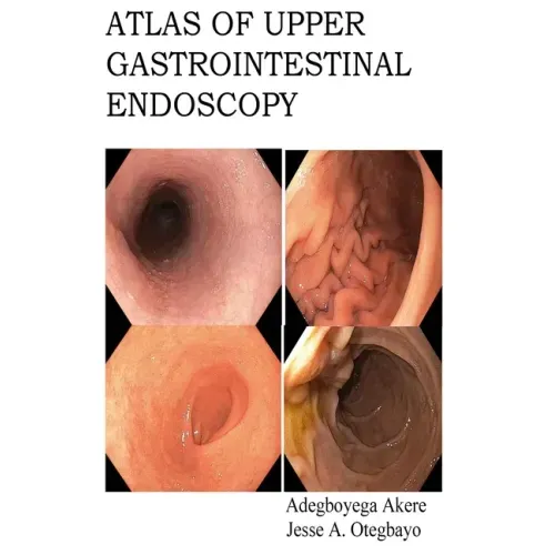 Atlas of Upper Gastrointestinal Endoscopy