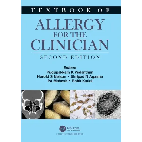 Textbook of Allergy for the Clinician
