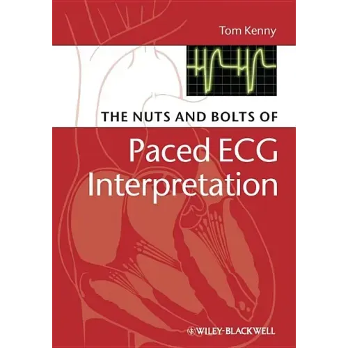 The Nuts and Bolts of Paced ECG Interpretation