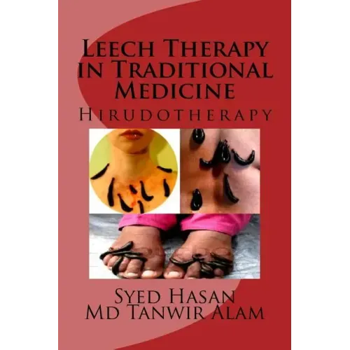 Leech Therapy in Traditional Medicine: Hirudotherapy