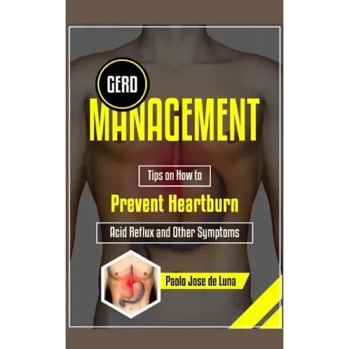 GERD Management: Tips On How To Prevent Heartburn, Acid Reflux And Other Symptoms - Paperback