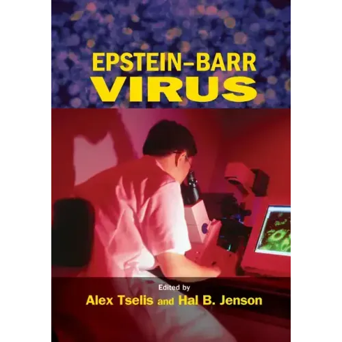 Epstein-Barr Virus