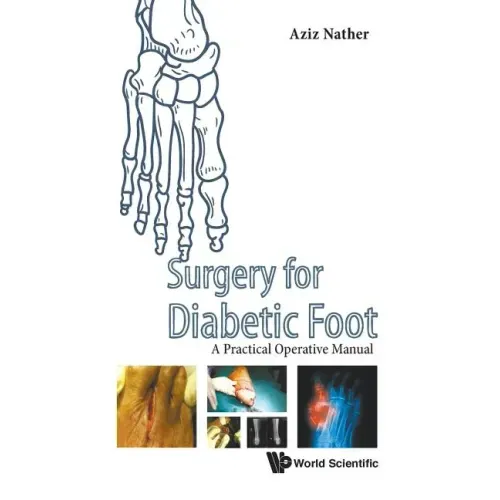 Surgery for Diabetic Foot: A Practical Operative Manual - Hardcover