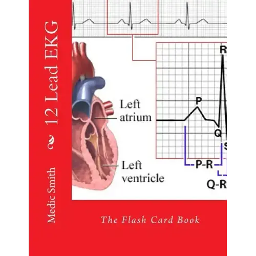12 Lead EKG: The Flash Card Book