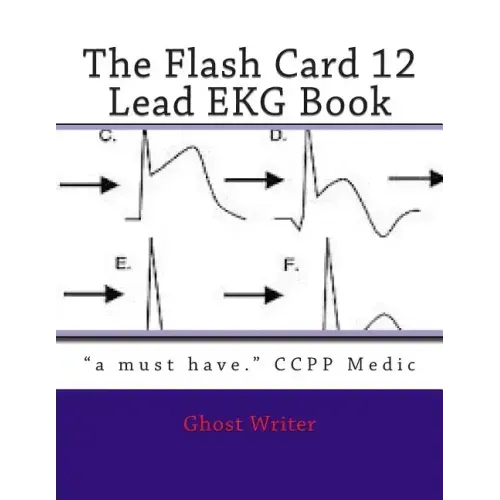 The Flash Card 12 Lead EKG