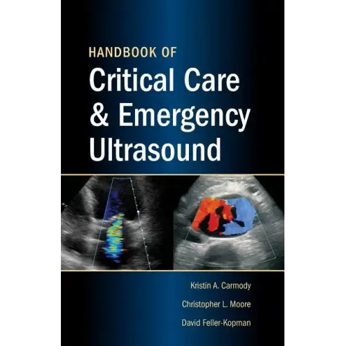 Handbook of Critical Care & Emergency Ultrasound - Paperback