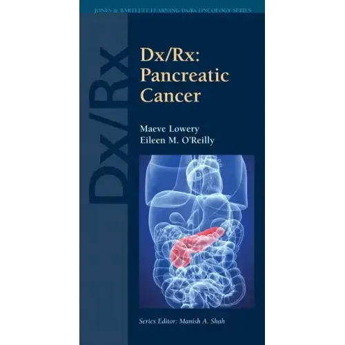 DX/Rx: Pancreatic Cancer: Pancreatic Cancer