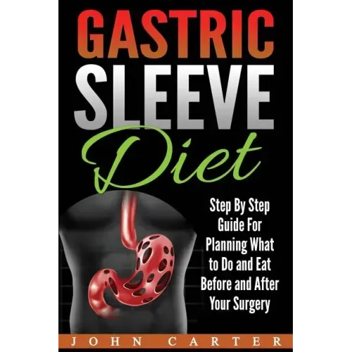 Gastric Sleeve Diet: Step By Step Guide For Planning What to Do and Eat Before and After Your Surgery