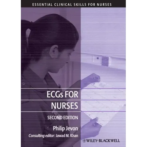 Ecgs for Nurses