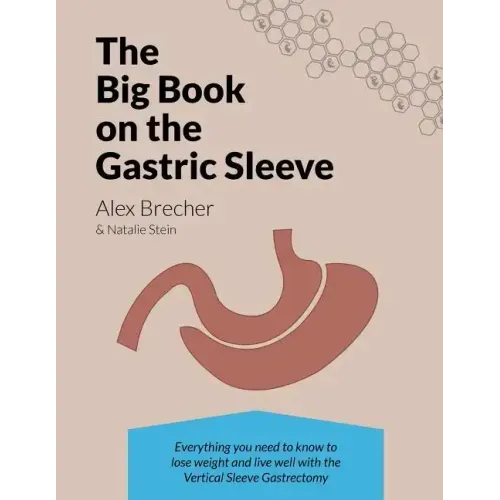 The Big Book on the Gastric Sleeve: Everything You Need to Know to Lose Weight and Live Well with the Vertical Sleeve Gastrectomy