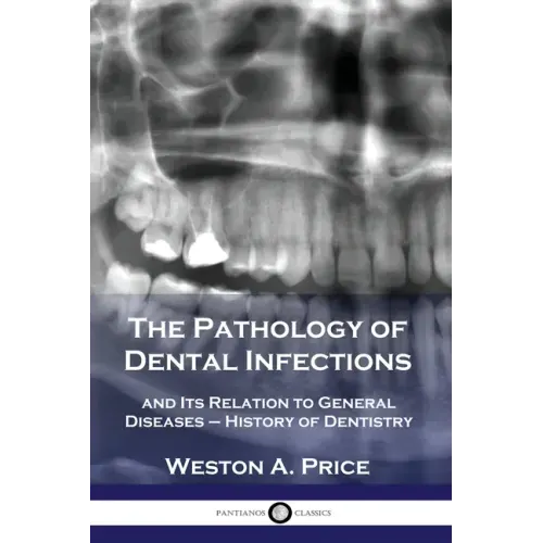 The Pathology of Dental Infections: and Its Relation to General Diseases - History of Dentistry
