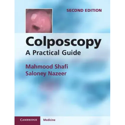 Colposcopy