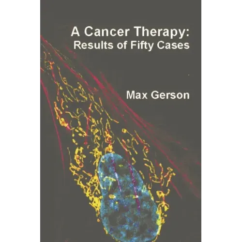 A Cancer Therapy: Results of Fifty Cases - Paperback