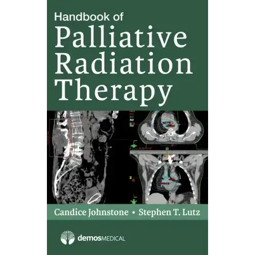 Handbook of Palliative Radiation Therapy