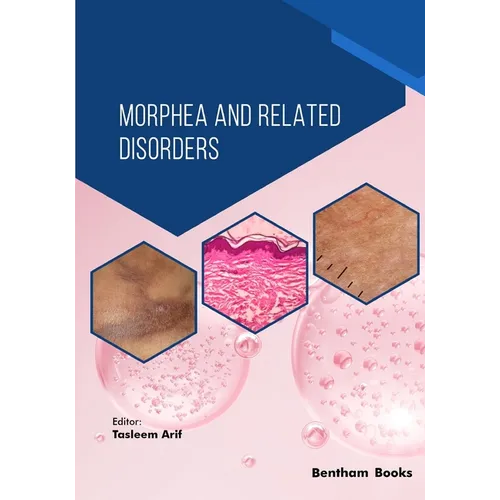 Morphea and Related Disorders