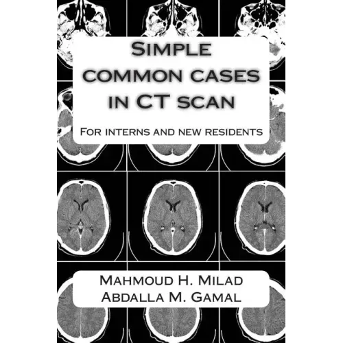 Simple common cases in CT scan: For interns and new residents