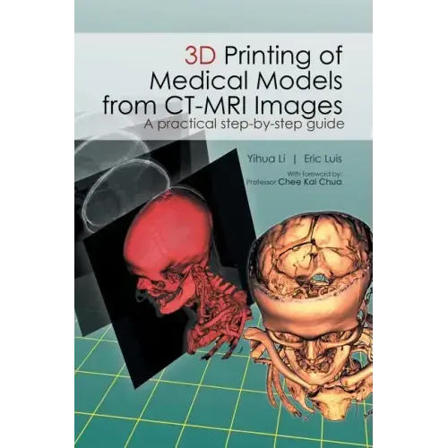 3D Printing of Medical Models from CT-MRI Images: A Practical step-by-step guide