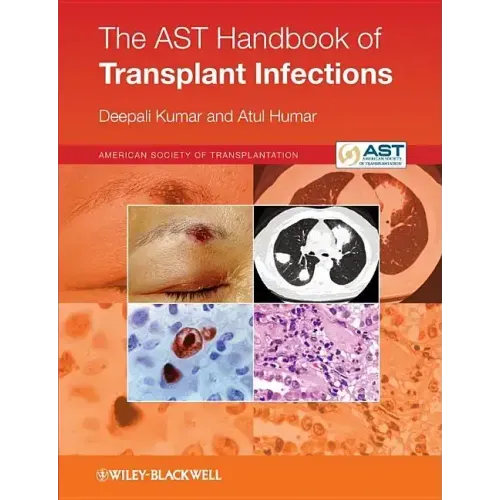 The Ast Handbook of Transplant Infections