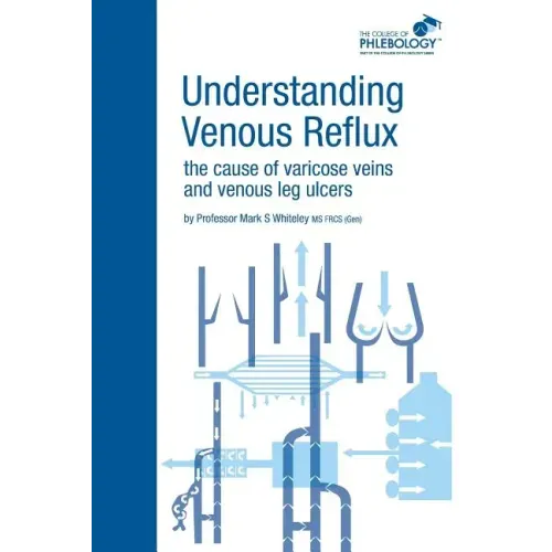 Understanding Venous Reflux the Cause of Varicose Veins and Venous Leg Ulcers: Varicose veins and venous leg ulcers
