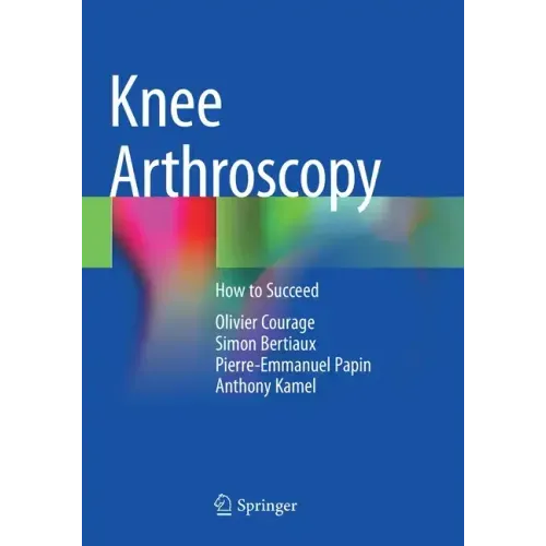 Knee Arthroscopy: How to Succeed