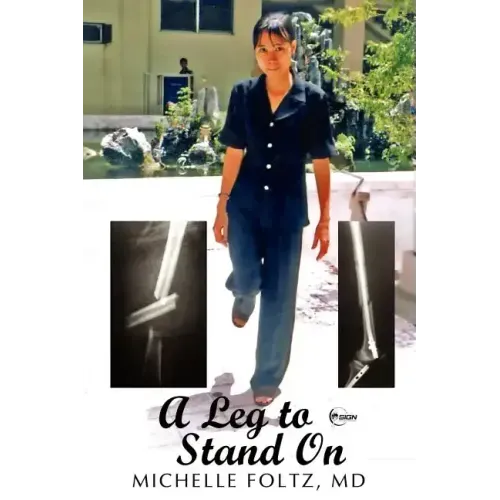 A Leg to Stand On