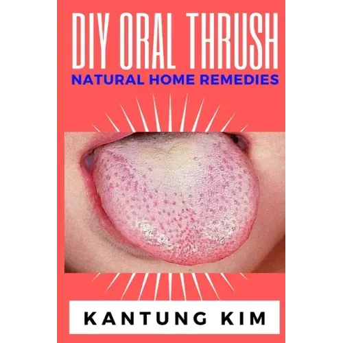 DIY Oral Thrush Natural Home Remedies: The Effective Step By Step Guide To Permanently End Oral Thrush
