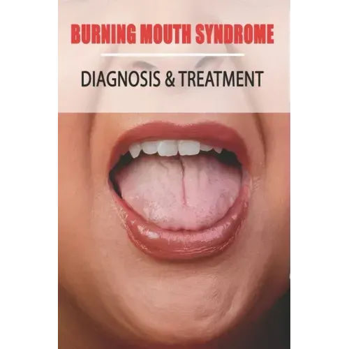 Burning Mouth Syndrome: Diagnosis & Treatment: Burning Mouth Syndrome Guide